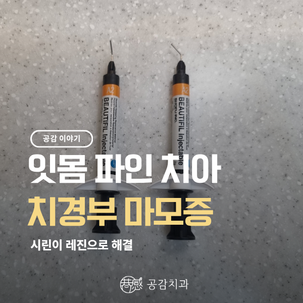 찬물 마실 때 찌릿! 치경부 마모증 원인과 레진 치료법 완벽 정리 (우만동 공감치과)